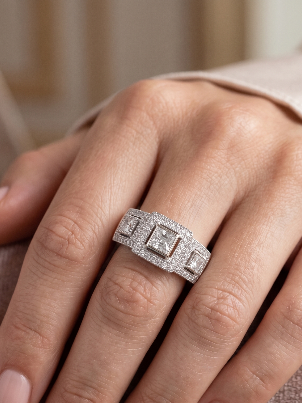 Anillo placa